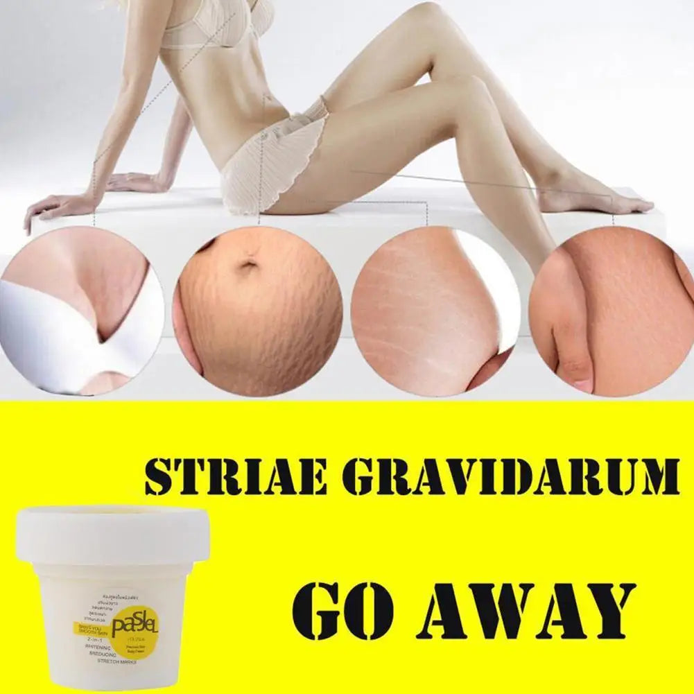 Stretch Mark Repair Cream