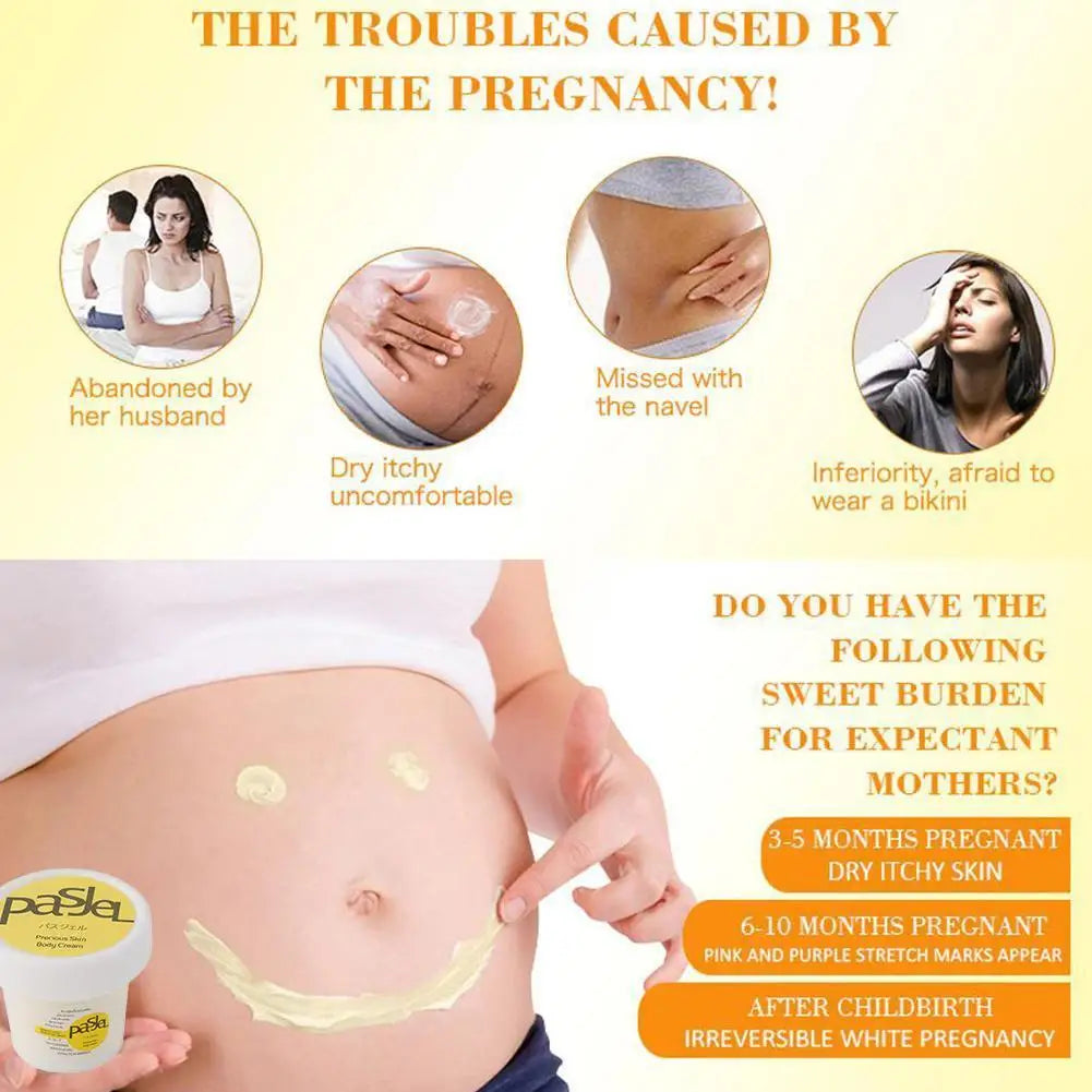 Stretch Mark Repair Cream